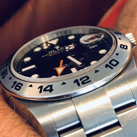 rolex watch scratches